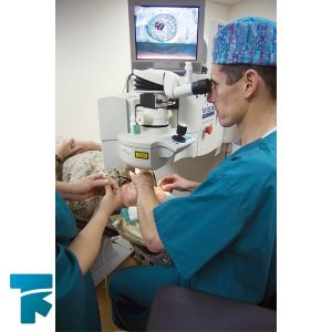 جراحی انکسار برای درمان پیر چشمی