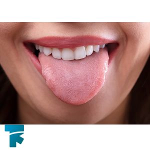 تاثیر گل گاو زبان بر سلامت دهان 